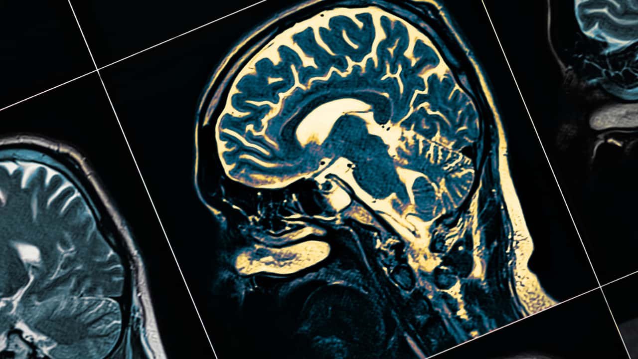 Estes dois sinais ocultos podem indicar Parkinson